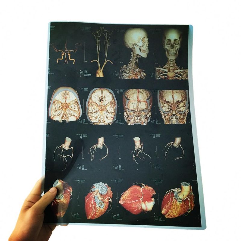 Brand Quality Dry Inkjet Printing Imaging Medical X-ray Film