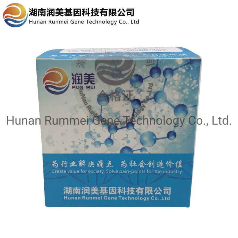 Pre-Packed Kit for Detection of Triple Nucleic Acid for Pertussis, Parapertussis,