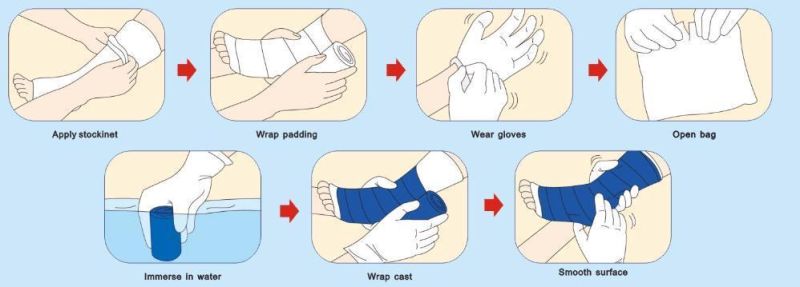 Various Sizes Orthopedic Fiberglass Casting Tape for Medical Use