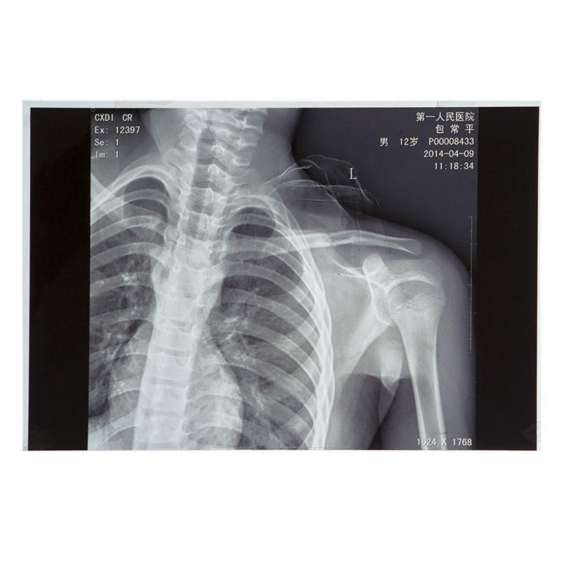 Radiology Medical Dry Inkjet X Ray Film for Hospital Film Printer