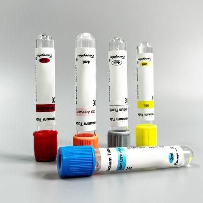 Siny Vacuum Blood Collection Tube Gel Tube for Medical Lab