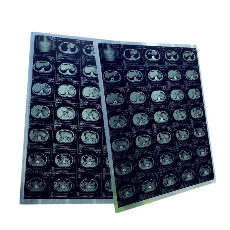 14X17 in and 11X14 in Medical Thermal X-ray Dry Film