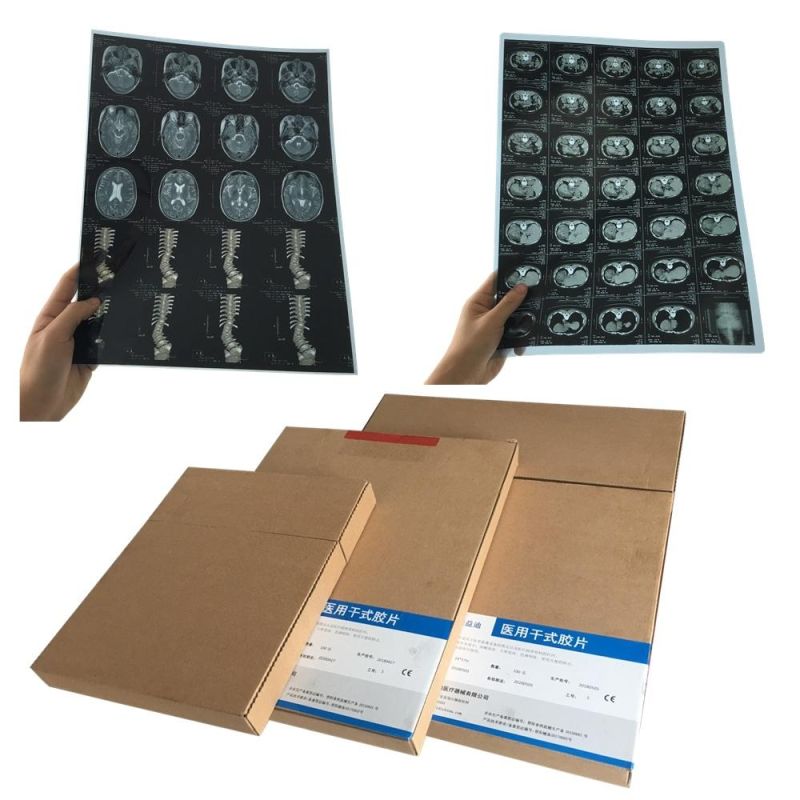 Medical Pet Blue Inkjet X-ray Film for Cr CT MRI