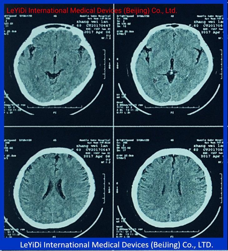 Dr Imaging System Using Inkjet Medical X Ray Films