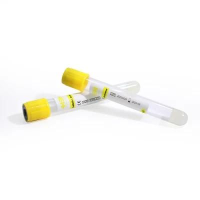 Cheap Price 5ml 6ml 7ml 9ml 10ml PET Glass Plastic Yellow Cap Sterile Gel &amp; Clot Activator Tube for Medical