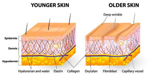 Neuramis Rejeunesse Dermalax Yvoire Revolax Hyafilia Sculptra Filler