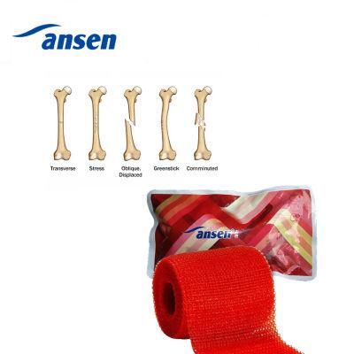 Orthopedic Fiberglass Casting Tape Bandage Plaster Cast Synthetic Scotch Cast 2&quot;