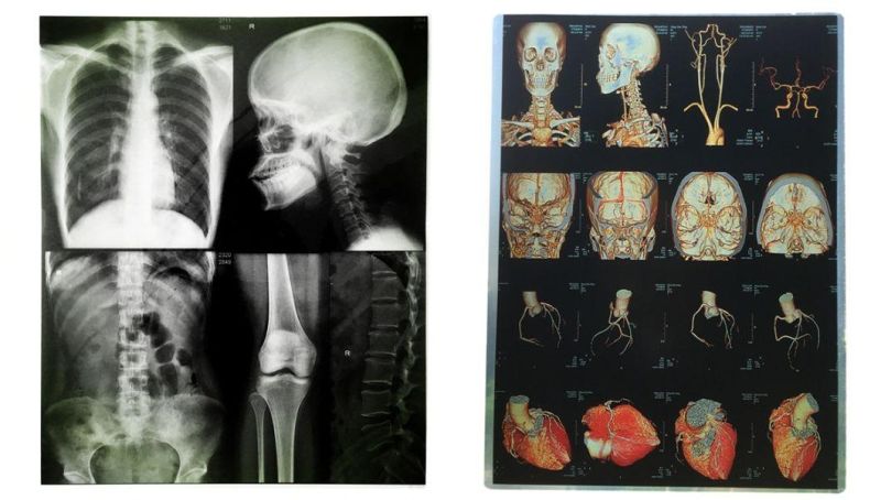 Agfa Printer Usage Medical X-ray Blue Thermal Films