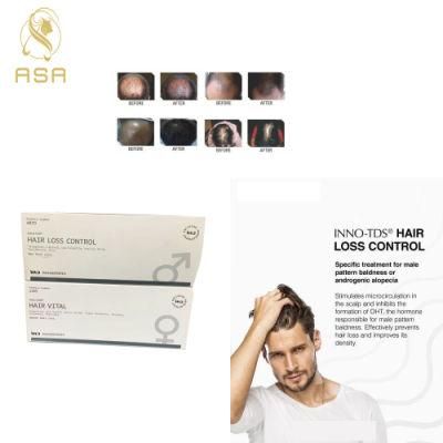 Innoaesthetics Hair Loss Control for Man to Growth Hair Innoaesthetics Hair Loss Control