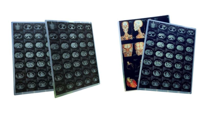 35*43cm Thermal X-ray Films Blue