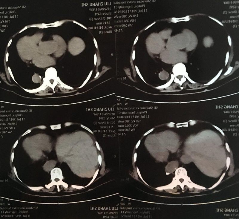 Leyidi Medical X Ray Film Blue Sensitive Films