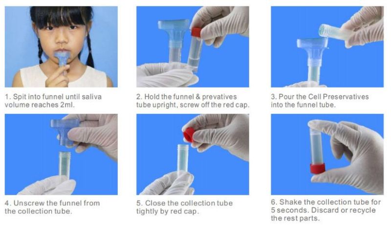 Stool Breed Cheek China Amies Ample Nylon Elisa Paint Homes Smart Sampling Saliva Collection Swab Free Sample Good Price