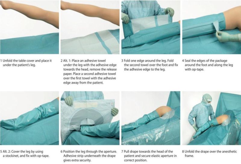 Disposable Hip Orthopedic Surgical Drape