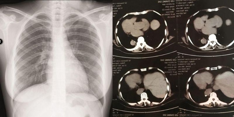 Medical CT and Cr X-ray/Dry Film