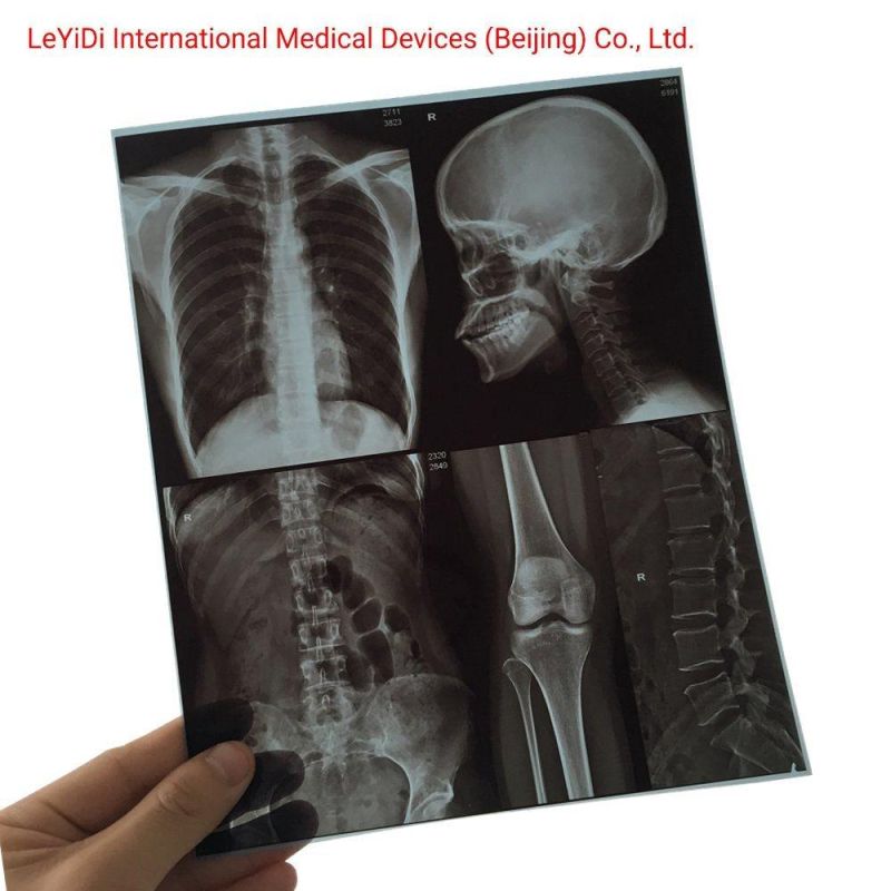 Brand Quality Dry Inkjet Printing Imaging Medical X-ray Film