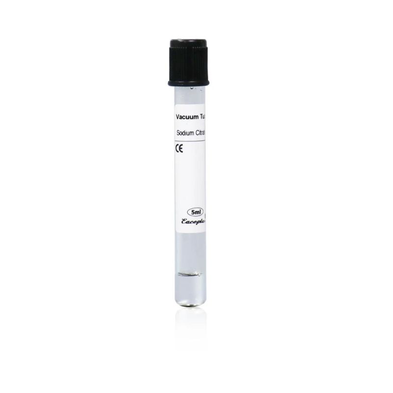 Siny Medical Supply 3.8% Sodium Citrate ESR Disposable Vacuum Blood Collection Tube with CE (2-10ml)