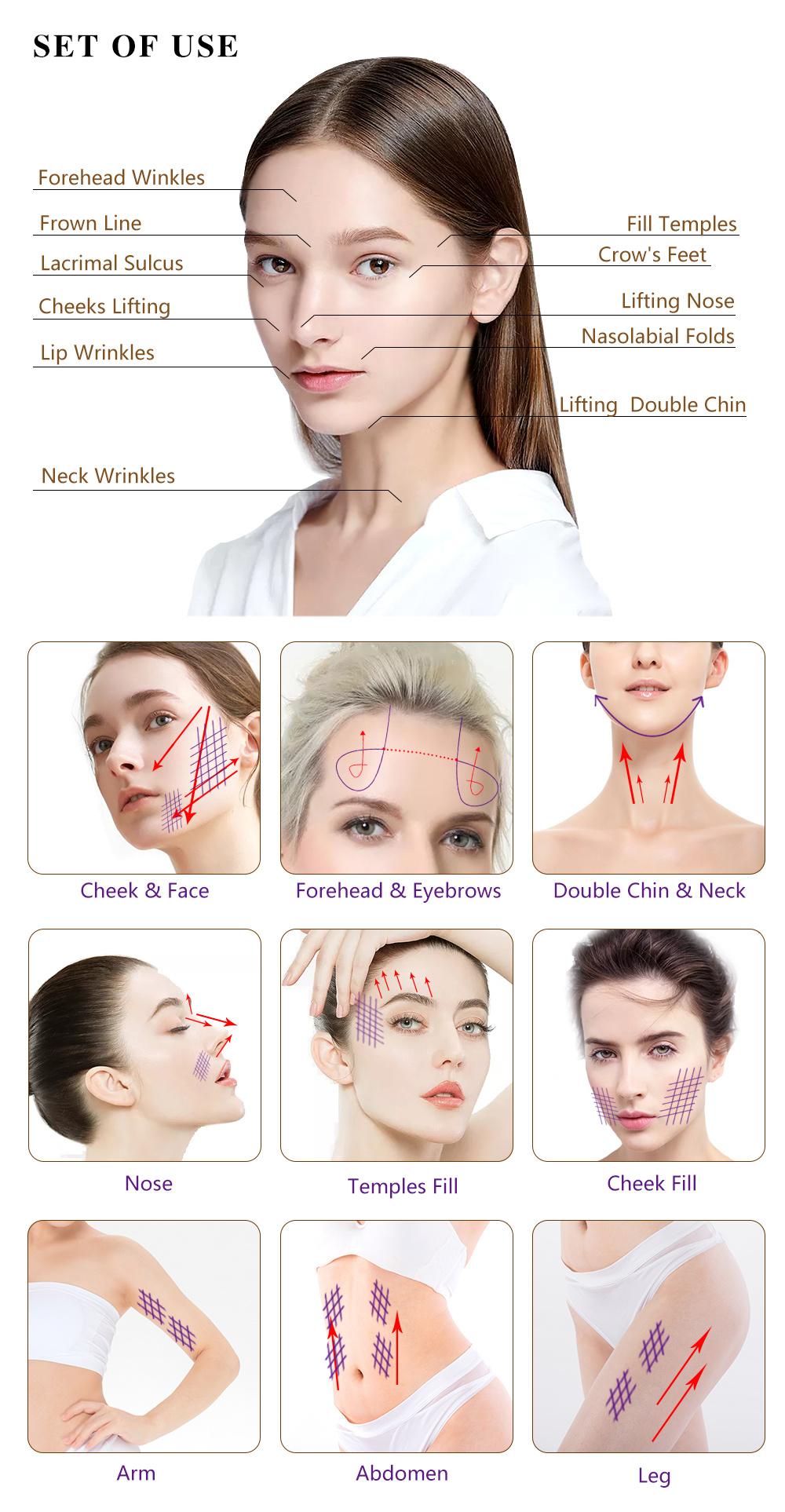 MID Face Sugar Skin Strings Threading Injection Full Facelift Cost Price