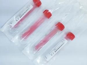 Collection Swab &amp; Virus Sampling Tube