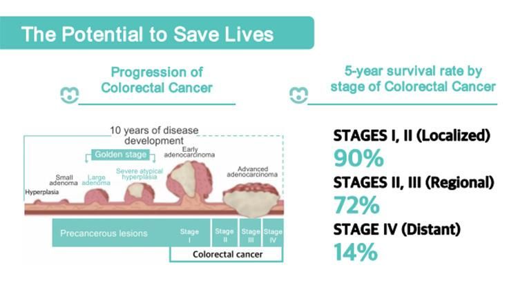 Combined Feces Occult Blood Test Kit 2-in-1 Fob/Trf, Colloidal Gold for Colorectal Cancer Noninvasive Screening