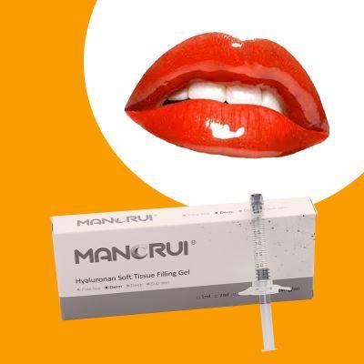 Easy Correction of MID-Depth Wrinkles Manorui Derm 2ml Cross Linked Hyaluronic Acid Gel