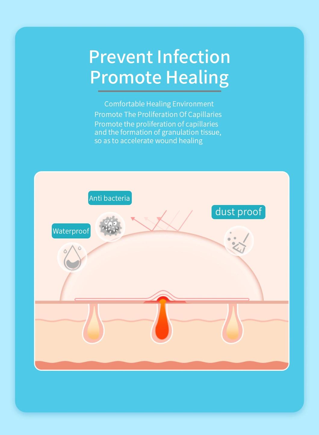 Oval Hydrocolloid Dressing Wound