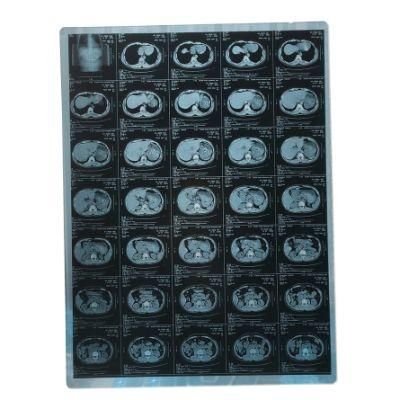 Medical Use Blue 10*12 Inch Inkjet Film