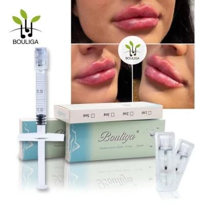 Cross Linked Injectable Hyaluronic Acid Hyaluron Lip Filler for Lips