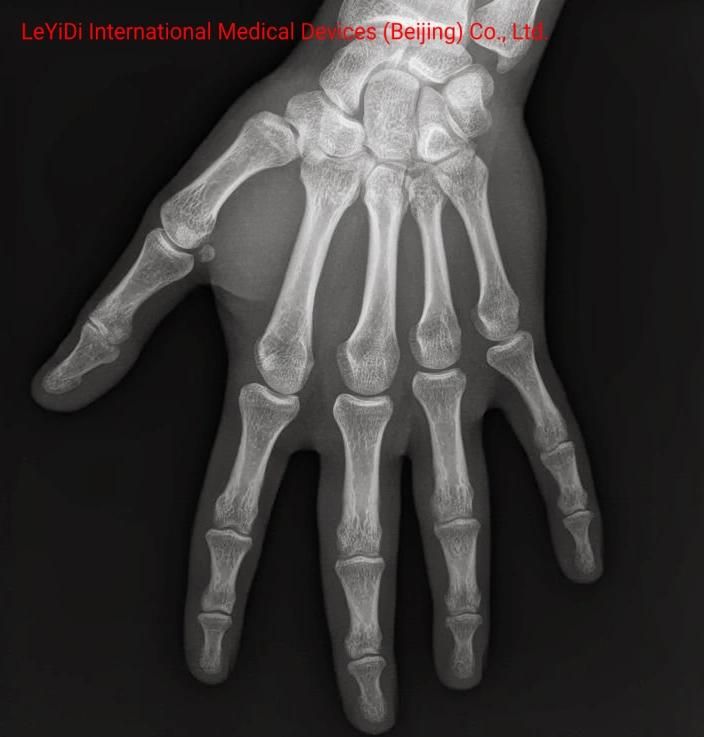 ISO and Ce Standard 35X43 Cm Medical X Ray Film for Hospitals