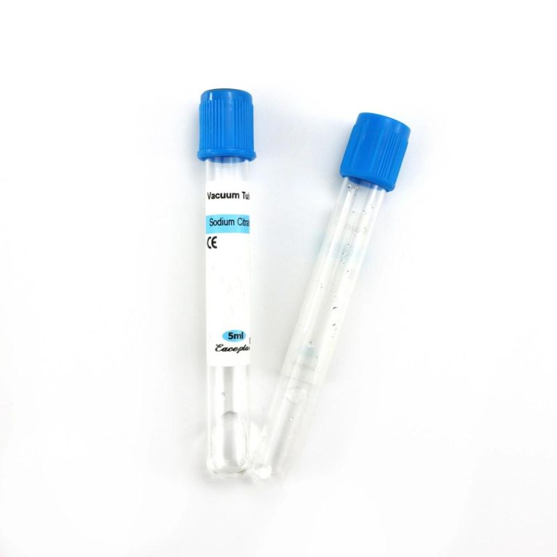 Siny Vacuum Blood Sampling Tube Sodium Citrate with CE