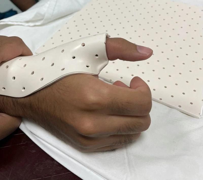 Prosthetic Orthosis Material Thermoplastic Splint Sheet Orthopedic Immobilization