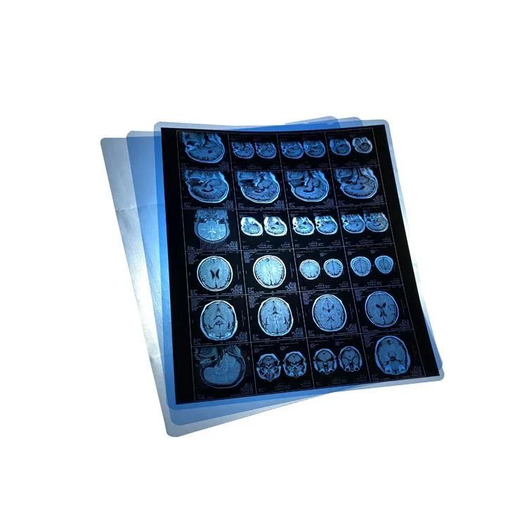 Digital X Ray Film Soft Ware Dicom Print Meidcal Blue Positive Pet Film for CT Cr Dr MRI