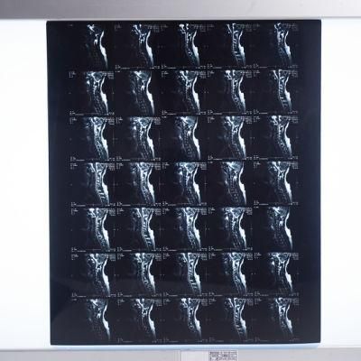 Blue Color Medical Dry Imaging Film with FUJI Printer 3500/Agfa5302