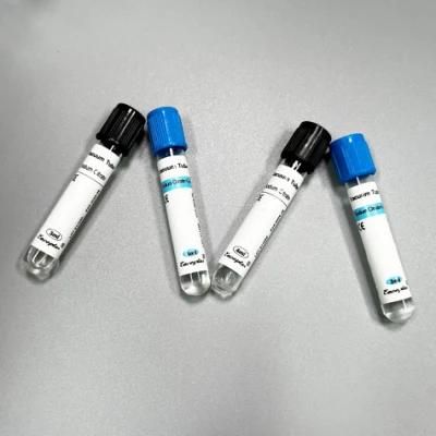 Siny Blue Gel&Sodium Citrate Disposable Medical Supplies Vacuum Tube