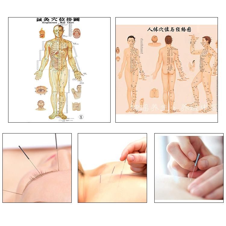 Chinese Manufacturer Sterile Alloy Handle Acupuncture Needle for Medical Without Guide Tube