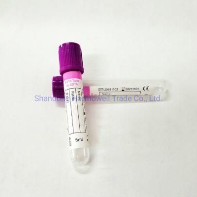 EDTA K2/K3 Vacuum Blood Collection Tube