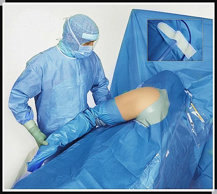 Disposable Eo Sterilized Knee Arthroscopy Drape