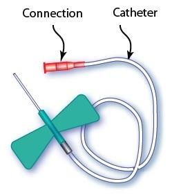 Hot Sale Disposable Infusion Set with Needle&Scalp Vein Set