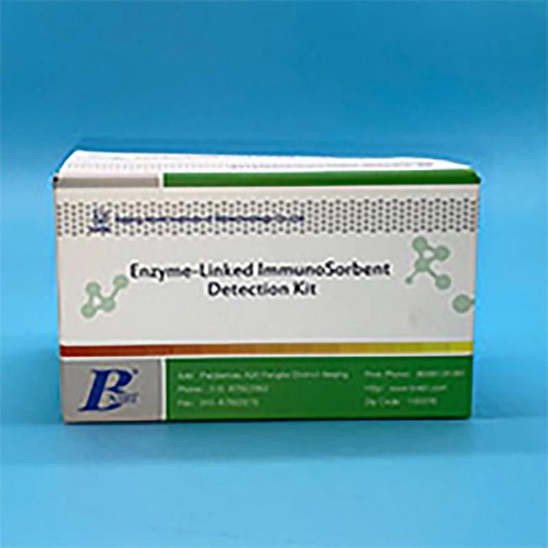 Hbcab Elisa Test Kit/Hepatitis B Surface Antigen Elisa Hospital Detection Test Reagent