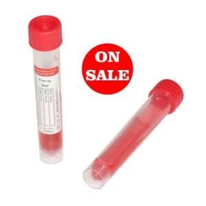 Virus Transport Medium Flocked Swab Kit Disposable Virus Sampling Tube Vtm Tube