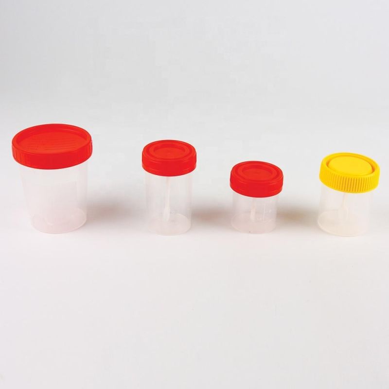 Stool Container with Spoon 30ml Disposable and Graduated Plastic Specimen Cup Urine Collector