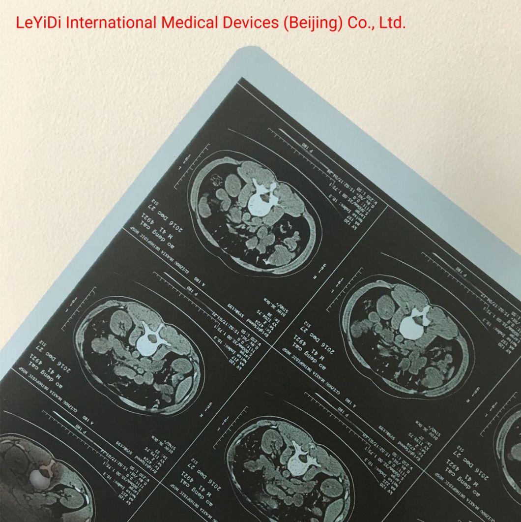 Hot Selling Dry Medical Ultrasound Films for Ultrasound Image Printing