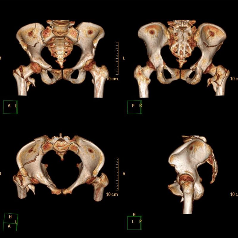 Dr Imaging System Using Inkjet Medical X Ray Films