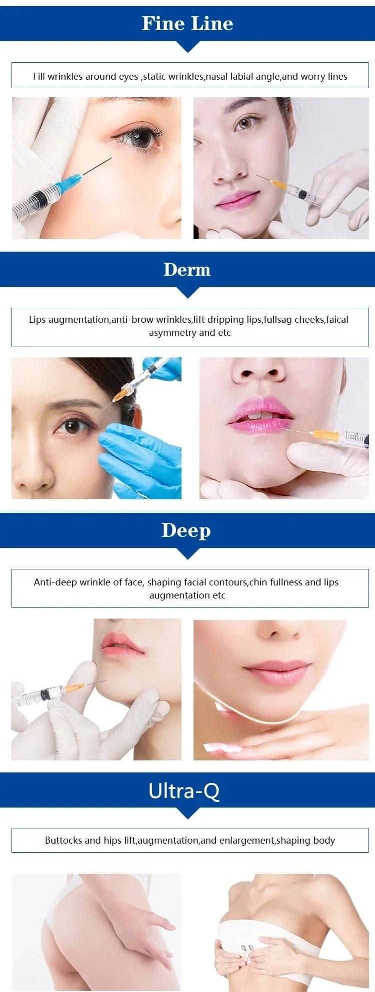 Hyaluronic Acid Facial Filler to Keep Skin Younger