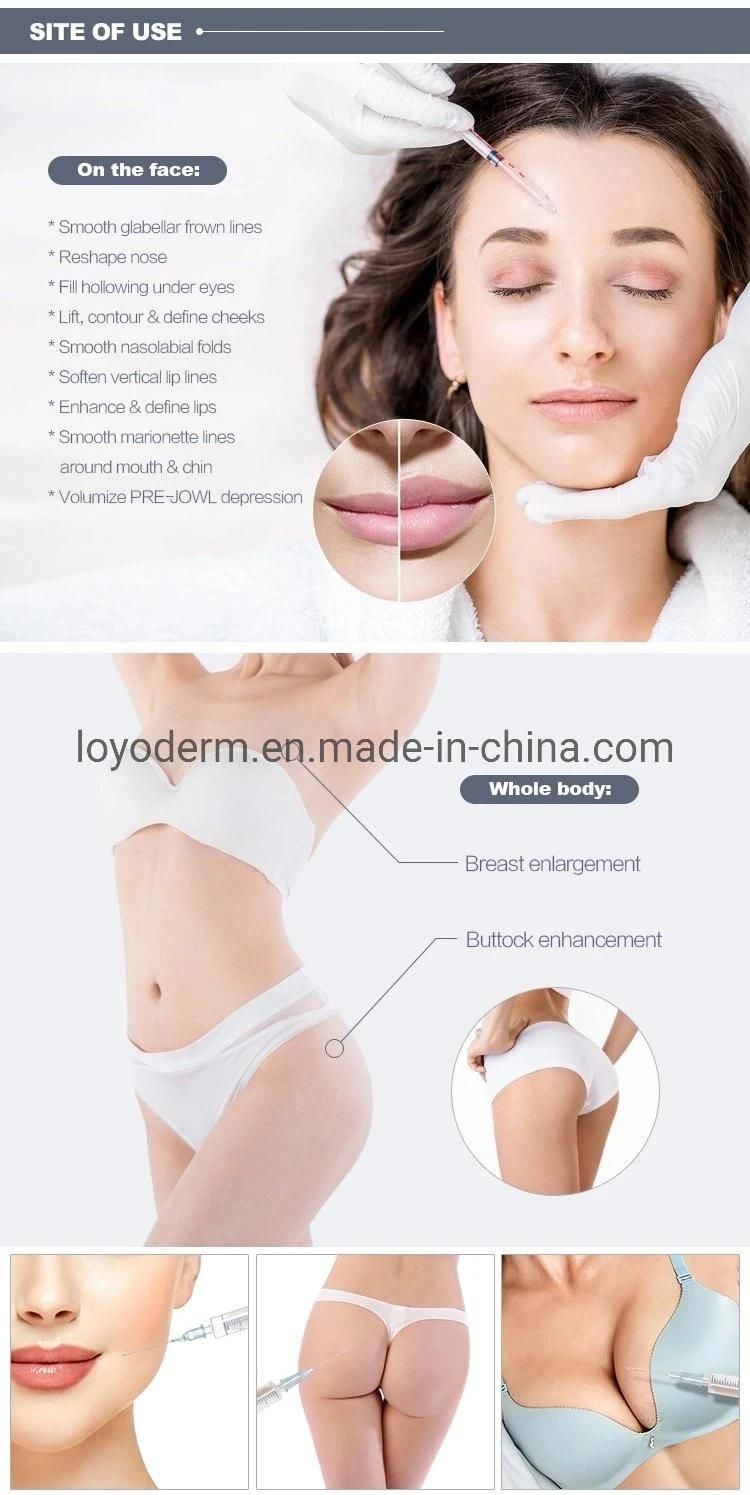 10ml Facial Sculpting Cross-Linked Dermal Filler for Facial Injection