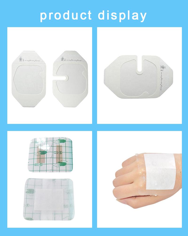 China Sterile Medical Transparent PU Island Wound Dressing