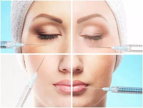 Medium Forehead Lines Facial Wrinkles Treatment Hyaluronic Acid Dermal Filler