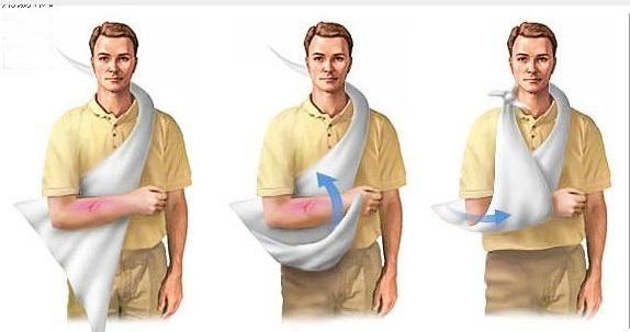 First Aid Arm Sling Bandage Nonwoven 30GSM or 40 GSM Surgical Triangular Bandage with ISO/Ce/FDA