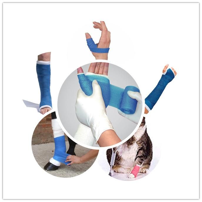 Chinese Factory Wholesale Flexible Durable Medical Orthopedic Polymer Splint