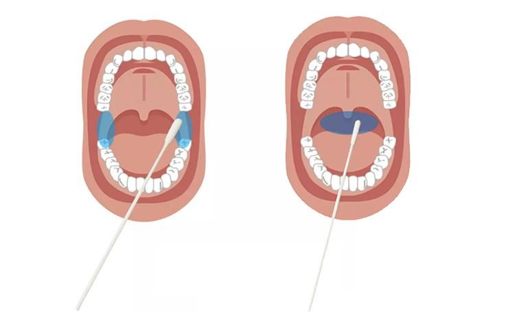 Medical Disaposable Testing Oral Nylon Throat Flocked Swab Sampling Swab Medical Disposable Swabs