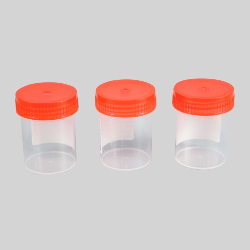 Stool Specimen Collection Container Urine Sample Cup